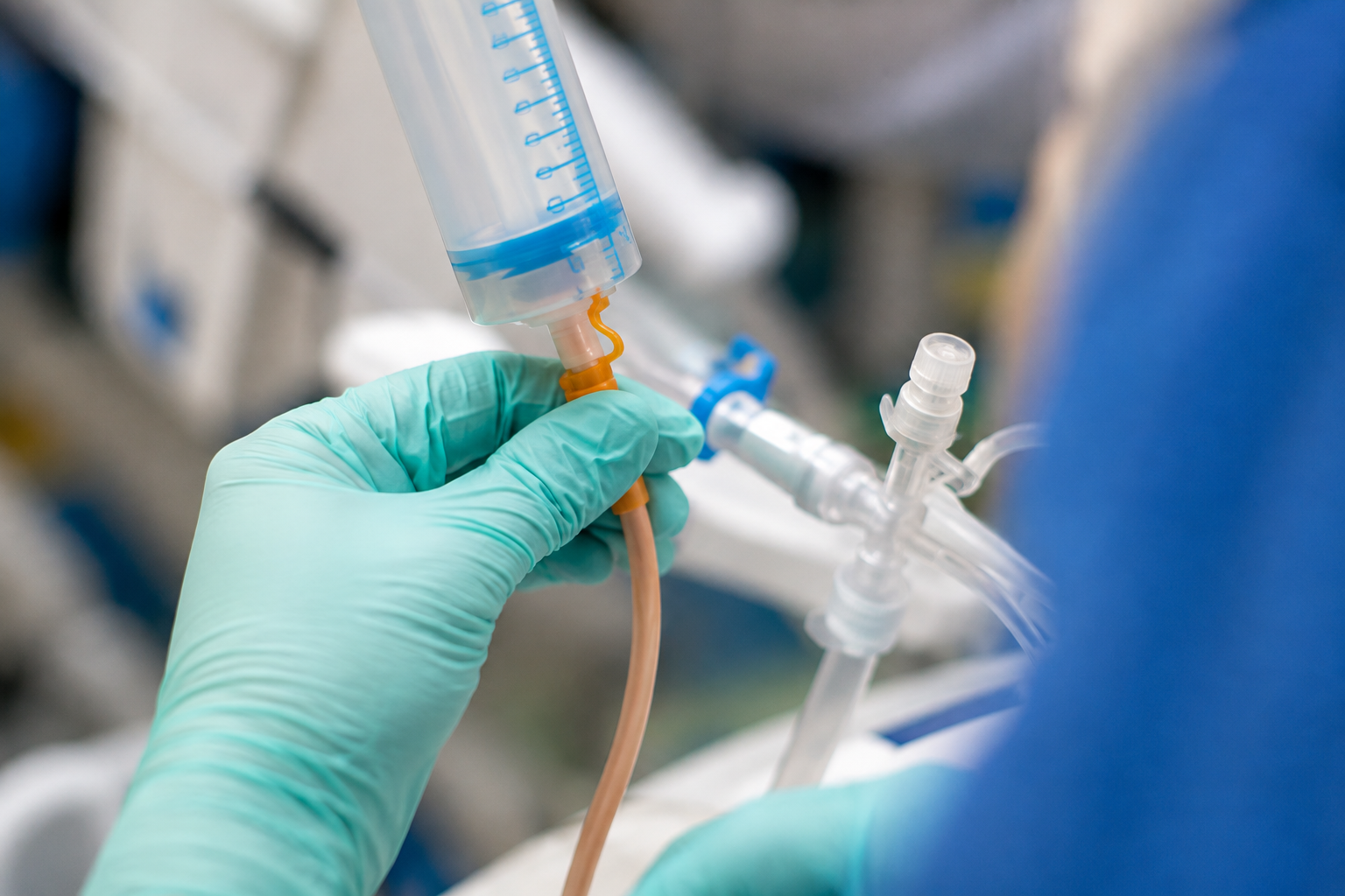 Close-up van een hand met medische handschoen die een spuit met een aangesloten slangetje vasthoudt bij een transparant medisch aansluitingssysteem.